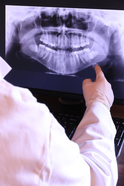 Best Emergency Dentist for Knocked-Out Tooth in Humboldt, KS